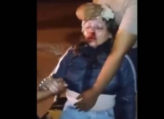 BARRIO SOLIDARIDAD: ENERGÚMENO GOLPEÓ HASTA CASI MATAR A UNA MUJER