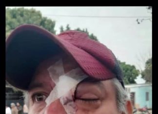 LO QUE DEJÓ EL VIOLENTO DESALOJO DE OBREROS MUNICIPALES EN HIPÓLITO YRIGOYEN