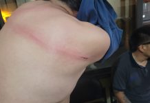 VENDEDOR AMBULANTE AGREDIÓ CON UNA CADENA A UN INSPECTOR MUNICIPAL EN PLAZA 9 DE JULIO