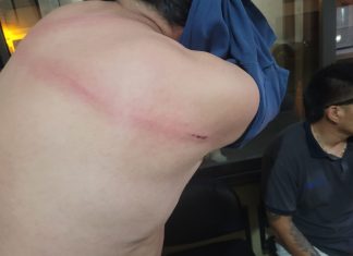 VENDEDOR AMBULANTE AGREDIÓ CON UNA CADENA A UN INSPECTOR MUNICIPAL EN PLAZA 9 DE JULIO