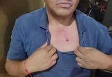 PIDEN PRISIÓN PREVENTIVA TRAS AMENAZAS Y LESIONES EN UN OPERATIVO DE CONTROL DE PIROTECNIA