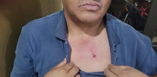 PIDEN PRISIÓN PREVENTIVA TRAS AMENAZAS Y LESIONES EN UN OPERATIVO DE CONTROL DE PIROTECNIA